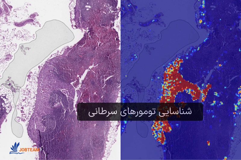 بازار کارهای علم داده ایجاد شده توسط گوگل: شناسایی تومورهای سرطانی بازار کارهای علم داده ایجاد شده توسط گوگل: شناسایی تومورهای سرطانی
